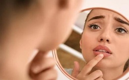 COVID-19 có thể làm phát sinh các biến chứng về da?