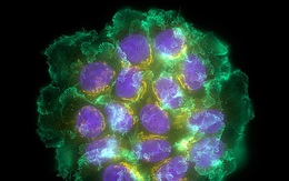 Giả thuyết ung thư "thành tinh": Khi sống đủ lâu, các khối u sẽ tiến hóa thành sinh vật lây nhiễm?