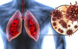 Khó thở dai dẳng là dấu hiệu tổn thương phổi ở bệnh nhân mắc COVID-19