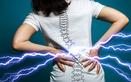 9 thực phẩm hỗ trợ giảm đau nhức xương khớp hậu COVID-19