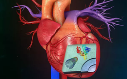 Công nghệ mRNA có thể giúp điều trị bệnh đau tim