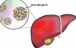 Sở Y tế TP HCM khuyến cáo tình trạng trẻ mắc viêm gan cấp chưa rõ nguyên nhân