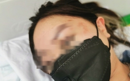 Cô gái trẻ tố bị người đàn ông sàm sỡ, hành hung tại Aeon Mall Long Biên