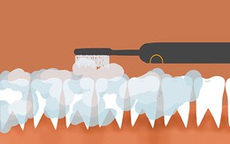 Siêng đánh răng giúp kéo dài tuổi thọ? Tránh ngay 2 thời điểm "độc hại" làm hỏng men răng và tổn thương cơ thể
