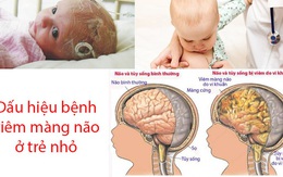 Những dấu hiệu nào báo hiệu bệnh viêm màng não ở trẻ em?