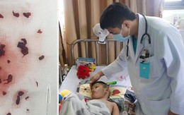 Bé trai 4 tuổi bị đột quỵ sau khi mắc COVID-19