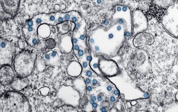 Một số ca Covid-19 mạn tính đã tạo nên biến chủng mới?