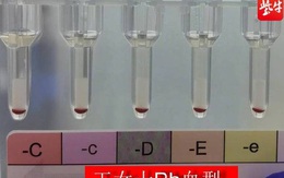 Phát hiện 2 người có nhóm ‘máu vàng’ hiếm nhất trên thế giới tại Trung Quốc