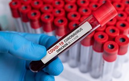 Đại dịch Covid-19 đã đến chặng cuối?