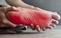 Cảm giác kiến bò ở lòng chân có thể cảnh báo bệnh lý mãn tính nguy hiểm