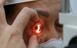 6 "không" trong thời điểm dịch đau mắt đỏ đang diễn biến phức tạp