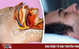 Giải mã lý do một số người không thể ngủ nếu không "ôm" một thứ gì đó