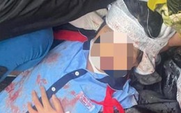 Nữ sinh lớp 6 bị gã thanh niên dùng búa đánh vào đầu: Thông tin mới nhất
