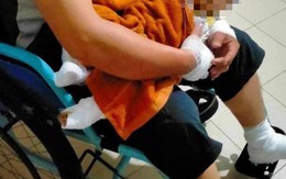 Cháu bé 4 tháng tuổi phỏng nặng vì dính "bom xăng" đòi nợ