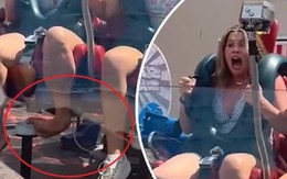 Sự cố đáng sợ ở công viên giải trí: Cô gái bị uốn cong gập bàn chân