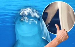 Các nhà sinh học biển gần đây đã phát hiện ra một con cá heo có 'ngón tay cái' giống con người