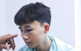 Bình Định: Học sinh lớp 10 bị đánh hội đồng nhập viện