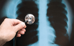 3 thứ mà phổi 'sợ' nhất và 1 thói quen giúp phổi khoẻ: Đơn giản nhưng không phải ai cũng biết