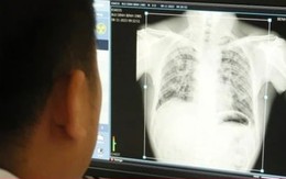 Vụ 6 công nhân tử vong do bụi phổi ở Nghệ An: Thêm 57 người mắc bệnh