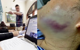 Clip phẫn nộ: Nữ trưởng phòng công chứng bị đá vào mặt giữa văn phòng