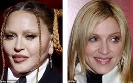 Bác sĩ thẩm mỹ nói về khuôn mặt không thể nhận ra của Madonna