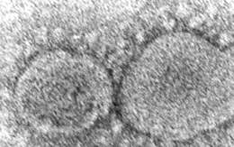 Mỹ quyết giải mật mọi thông tin tình báo về nguồn gốc COVID-19