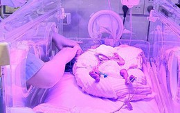 3 tháng diệu kỳ với bé gái sinh non ở tuần 24, nặng vỏn vẹn 700g