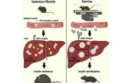 Vì sao tập thể dục thường xuyên có lợi cho sức khỏe?