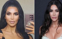 Nghiện phẫu thuật thẩm mỹ đến biến dạng,"bản sao" Kim Kardashian tử vong thương tâm