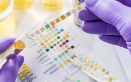 Màu nước tiểu nói gì về sức khỏe? Có dấu hiệu này cẩn thận gan, thận gặp vấn đề