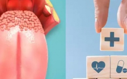 5 mùi vị trong miệng báo hiệu nhiều vấn đề về sức khỏe