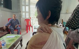 Thai phụ bị chồng bạo hành và cuộc tháo chạy khỏi 'địa ngục'