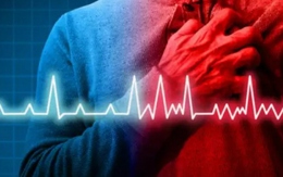 5 yếu tố khiến sức khỏe tim mạch của người khỏe mạnh xấu đi