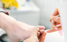 3 thay đổi ở móng chân báo hiệu vấn đề sức khỏe, một trong số đó cảnh báo loại ung thư khó phát hiện