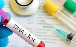 Mẹ chồng ép xét nghiệm AND thai nhi mới công nhận cháu