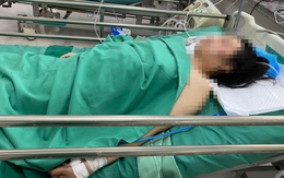 Huy động 10 bác sĩ cứu cô gái bị xe container cán ngang người