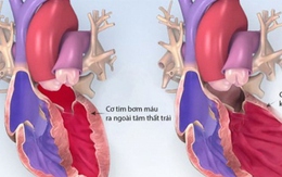 Bé 1 tuổi bị cao huyết áp