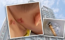 Xét nghiệm ADN dân cư cả tòa nhà 26 tầng tìm kẻ ném thuốc lá làm em bé bệnh nặng