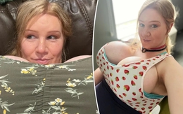 Người phụ nữ chuyển giới có bộ ngực nặng bằng đứa trẻ