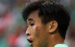 Cầu thủ Trung Quốc bị đạp xước mặt, trọng tài vẫn làm ngơ