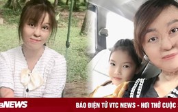 Sau 20 lần mổ, cô gái bị chồng đổ xăng đốt hôm mùng 2 Tết hiện ra sao?