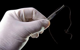 Chàng trai Việt kiều cầm 2 sợi tóc đi xét nghiệm ADN: Đọc kết quả xong chỉ biết buồn