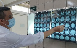 35 bệnh nghề nghiệp được đề xuất hưởng BHXH