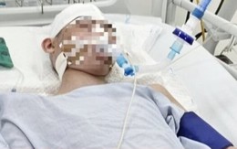 Sức khỏe nam sinh lớp 8 bị đánh chấn thương sọ não: Thông tin mới nhất