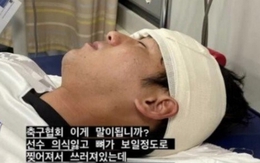 Dùng xe tải chở cầu thủ bị rách trán, lộ xương đi bệnh viện thay vì xe cứu thương, Hiệp hội bóng đá Hàn Quốc bị chỉ trích