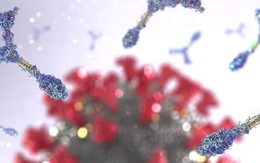 Phát hiện hội chứng tự miễn dịch mới liên quan COVID-19 gây ra bệnh phổi chết người