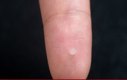 Trung Quốc tạo ra cảm biến gắn vào não nhỏ bằng hạt vừng