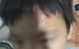 Điều tra vụ bé trai 10 tuổi nghi bị mẹ kế tiếp tục bạo hành