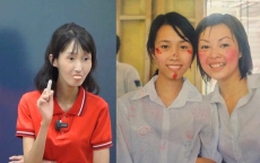 Cô giáo mầm non Hà Nội mắc bệnh lạ từ 'thiên nga' hóa 'vịt xấu xí'