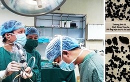 Nội soi lấy gần 1.000 viên sỏi đường mật trong gan bệnh nhân